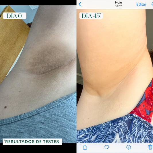 eBook - Inflamação Invisível
